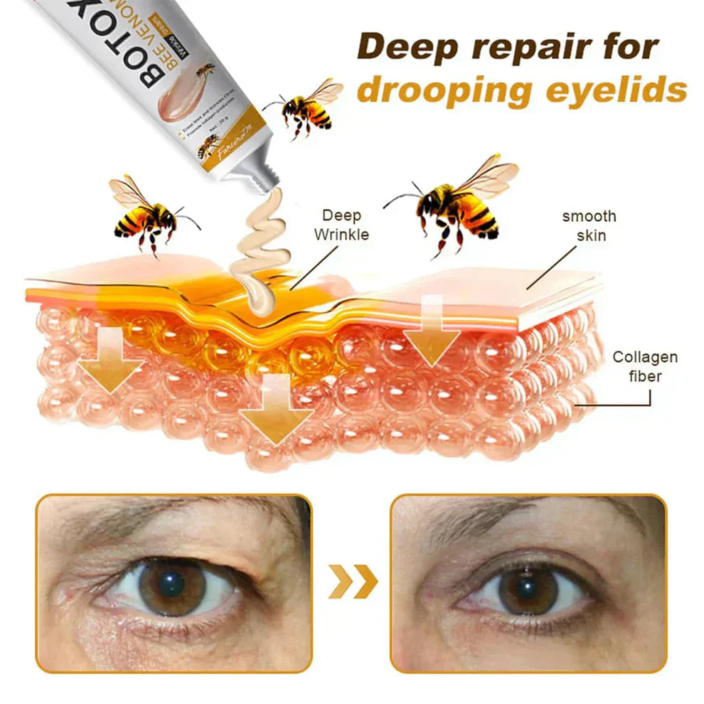 Botox Bee Venom Cream